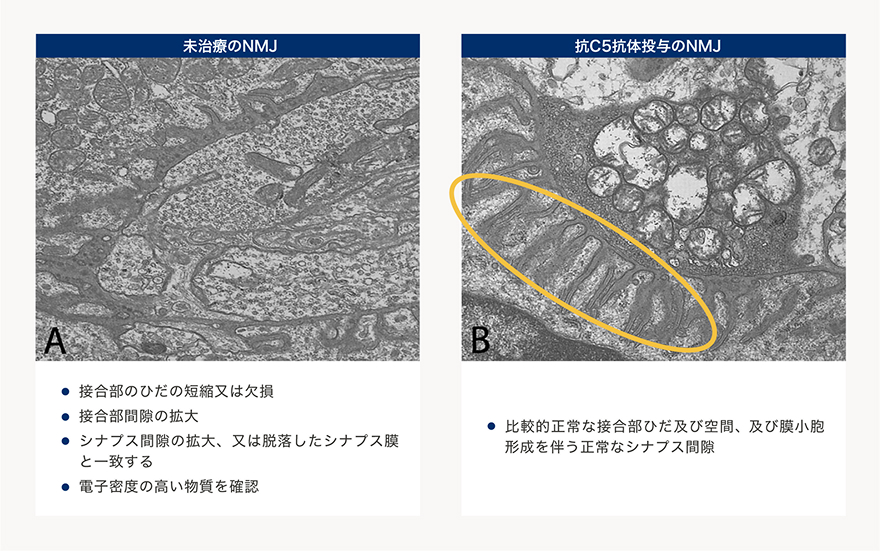 未治療のNMJと抗C5抗体投与のNMJ