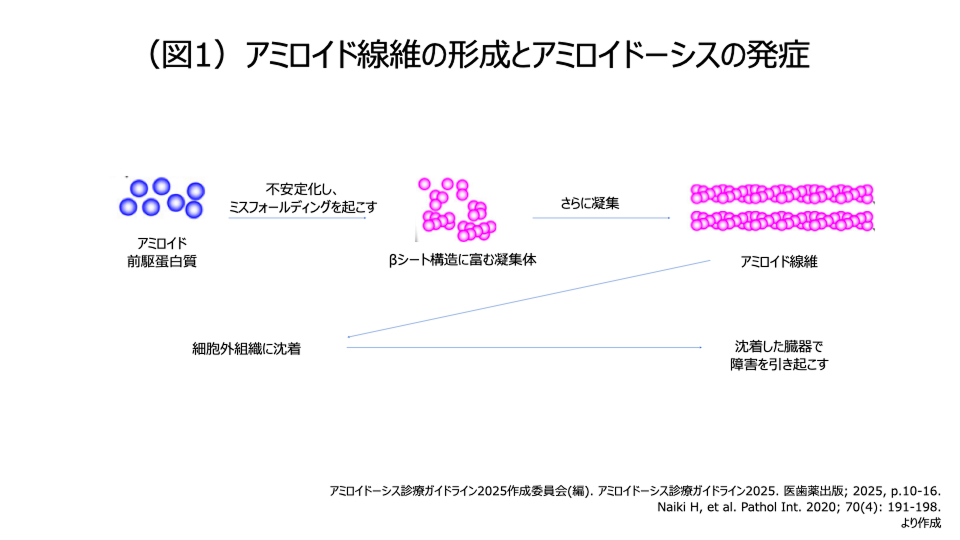 アミロイド線維の形成とアミロイドーシスの発症